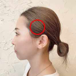 側頭筋が凝ると起こる症状
